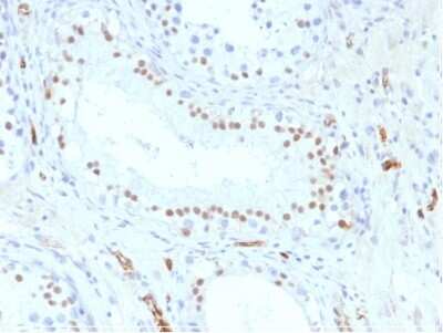 Immunohistochemistry-Paraffin: WT1 Antibody (WT1/857) [NBP2-44606]