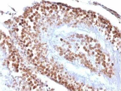 Immunohistochemistry-Paraffin: WT1 Antibody (rWT1/857) - Azide and BSA Free [NBP2-54592]