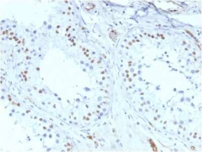 Immunohistochemistry-Paraffin: WT1 Antibody (rWT1/857) - Azide and BSA Free [NBP2-54592]