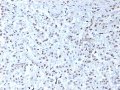 Immunohistochemistry-Paraffin: WT1 Antibody (rWT1/857) - Azide and BSA Free [NBP2-54592]