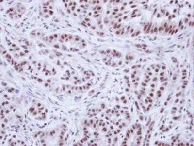 Immunohistochemistry: WTAP Antibody [NBP1-31777]
