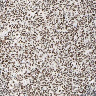 Immunohistochemistry-Paraffin: WTAP Antibody [NBP1-83040]