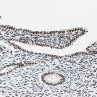 Immunohistochemistry-Paraffin: WTAP Antibody [NBP1-83040]