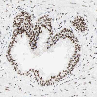 Immunohistochemistry-Paraffin: WTAP Antibody [NBP1-83040]