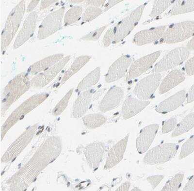 Immunohistochemistry-Paraffin: WTAP Antibody [NBP1-83040]