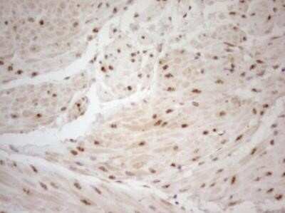 Immunohistochemistry: WTAP Antibody (OTI12G7) - Azide and BSA Free [NBP2-74870]
