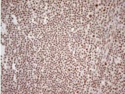 Immunohistochemistry: WTAP Antibody (OTI12G7) - Azide and BSA Free [NBP2-74870]