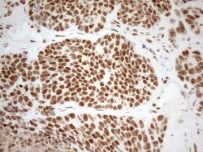 Immunohistochemistry: WTAP Antibody (OTI12G7) - Azide and BSA Free [NBP2-74870]