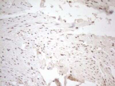 Immunohistochemistry: WTAP Antibody (OTI12G7) - Azide and BSA Free [NBP2-74870]