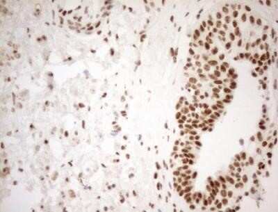 Immunohistochemistry: WTAP Antibody (OTI12G7) - Azide and BSA Free [NBP2-74870]