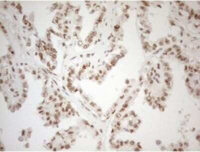 Immunohistochemistry: WTAP Antibody (OTI12G7) - Azide and BSA Free [NBP2-74870]