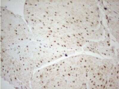 Immunohistochemistry: WTAP Antibody (OTI12G7) - Azide and BSA Free [NBP2-74870]