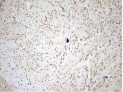 Immunohistochemistry: WTAP Antibody (OTI12G7) - Azide and BSA Free [NBP2-74870]