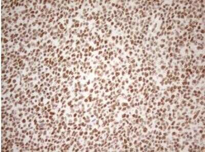 Immunohistochemistry: WTAP Antibody (OTI12G7) - Azide and BSA Free [NBP2-74870]