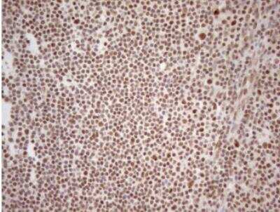 Immunohistochemistry-Paraffin: WTAP Antibody (OTI12G7) [NBP2-46368]