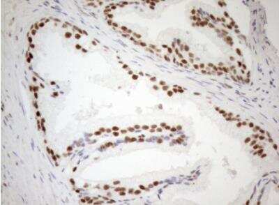 Immunohistochemistry-Paraffin: WTAP Antibody (OTI12G7) [NBP2-46368]