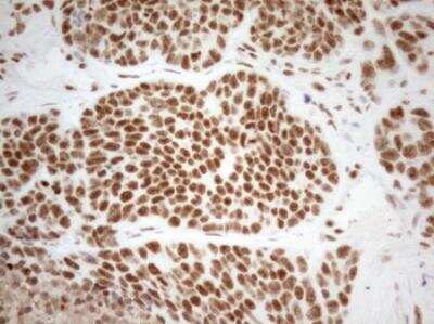 Immunohistochemistry-Paraffin: WTAP Antibody (OTI12G7) [NBP2-46368]