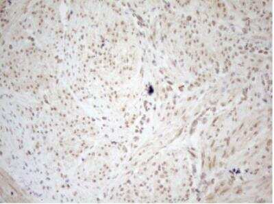 Immunohistochemistry-Paraffin: WTAP Antibody (OTI12G7) [NBP2-46368]