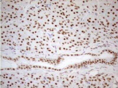 Immunohistochemistry-Paraffin: WTAP Antibody (OTI12G7) [NBP2-46368]