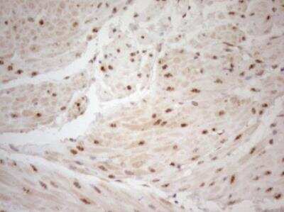 Immunohistochemistry-Paraffin: WTAP Antibody (OTI12G7) [NBP2-46368]