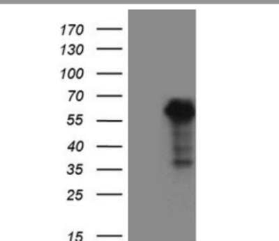 Western Blot: WTAP Antibody (OTI12G7) [NBP2-46368]