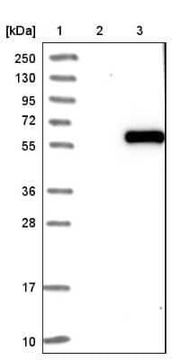 Western Blot: WTAP Antibody [NBP1-83041]