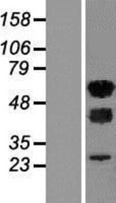 Western Blot: WTAP Overexpression Lysate [NBL1-17889]