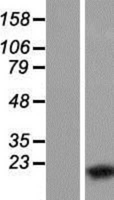 Western Blot: WTAP Overexpression Lysate [NBP2-05288]