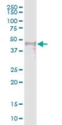 Western Blot: WTIP Antibody [H00126374-B01P]