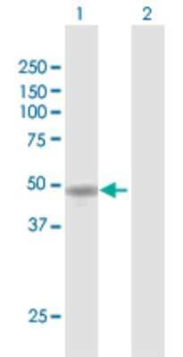 Western Blot: WTIP Antibody [H00126374-D01P]