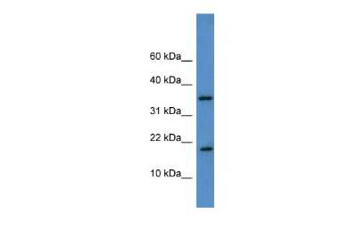 Western Blot: WW domain binding protein 5 Antibody [NBP2-83765]