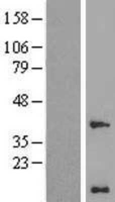 Western Blot: WW domain binding protein 5 Overexpression Lysate [NBL1-17783]