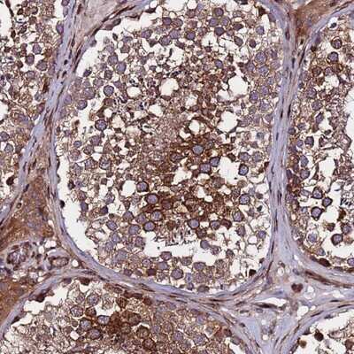 Immunohistochemistry-Paraffin: WWC2 Antibody [NBP1-92598]