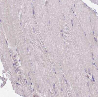 Immunohistochemistry-Paraffin: WWOX Antibody [NBP2-47579]