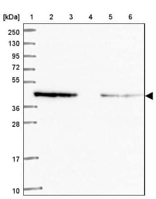 Western Blot: WWOX Antibody [NBP2-47579]