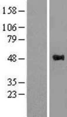 Western Blot: WWOX Overexpression Lysate [NBL1-17891]