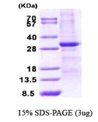 SDS-PAGE: Recombinant Human WWOX His Protein [NBC1-28766]