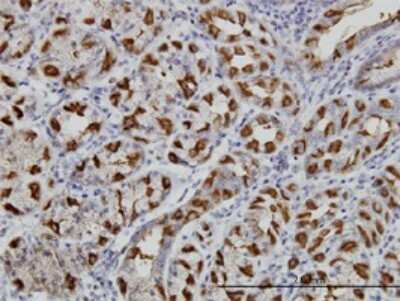 Immunohistochemistry-Paraffin: WWP1 Antibody (1A7) [H00011059-M01]