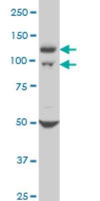 Western Blot: WWP1 Antibody (1A7) [H00011059-M01]