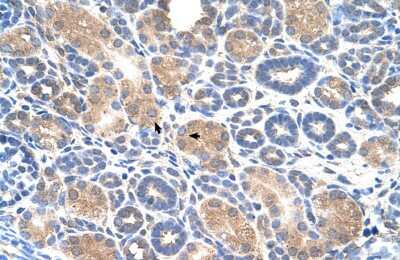 Immunohistochemistry: WWP2 Antibody [NBP3-10564]