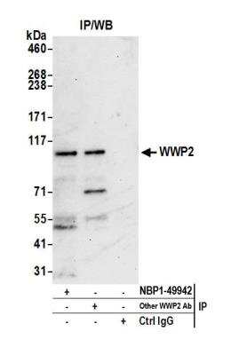 Immunoprecipitation: WWP2 Antibody [NBP1-49942]