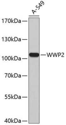 Western Blot: WWP2 AntibodyAzide and BSA Free [NBP2-93807]