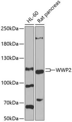 Western Blot: WWP2 AntibodyBSA Free [NBP2-95211]