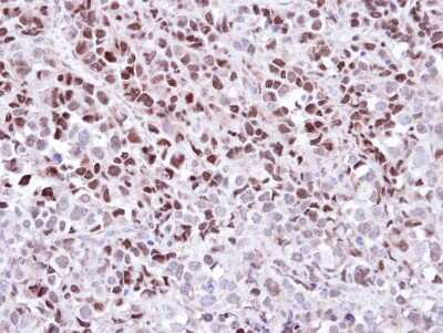 Immunohistochemistry-Paraffin: Wee1 Antibody [NBP1-33506]