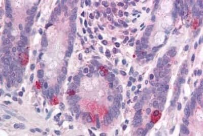 Immunohistochemistry-Paraffin: Wnt-1 Antibody [NBP3-14519]