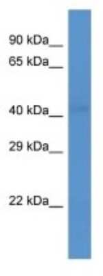 Western Blot: Wnt-1 Antibody [NBP3-10925]