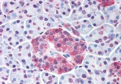 Immunohistochemistry-Paraffin: Wnt-10a Antibody - BSA Free [NB100-59026]