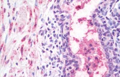 Immunohistochemistry-Paraffin: Wnt-10a Antibody - BSA Free [NB100-59026]