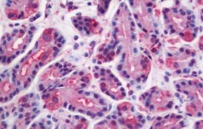 Immunohistochemistry-Paraffin: Wnt-10a Antibody - BSA Free [NB100-59026]