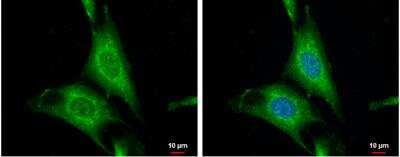 Immunocytochemistry/ Immunofluorescence: Wnt-10a Antibody [NBP1-33039]